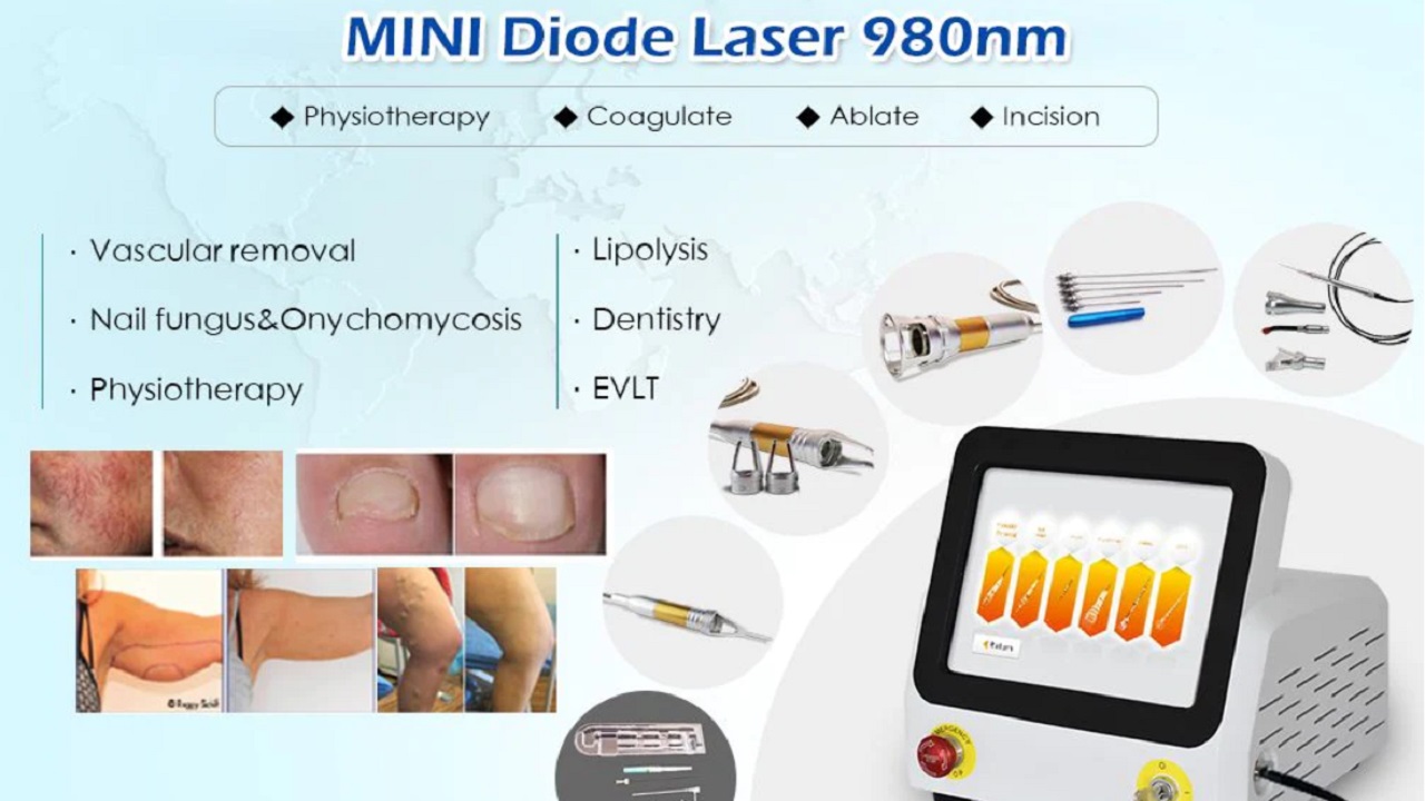 Understanding Vascular Removal: A Comprehensive Guide to Laser Treatment