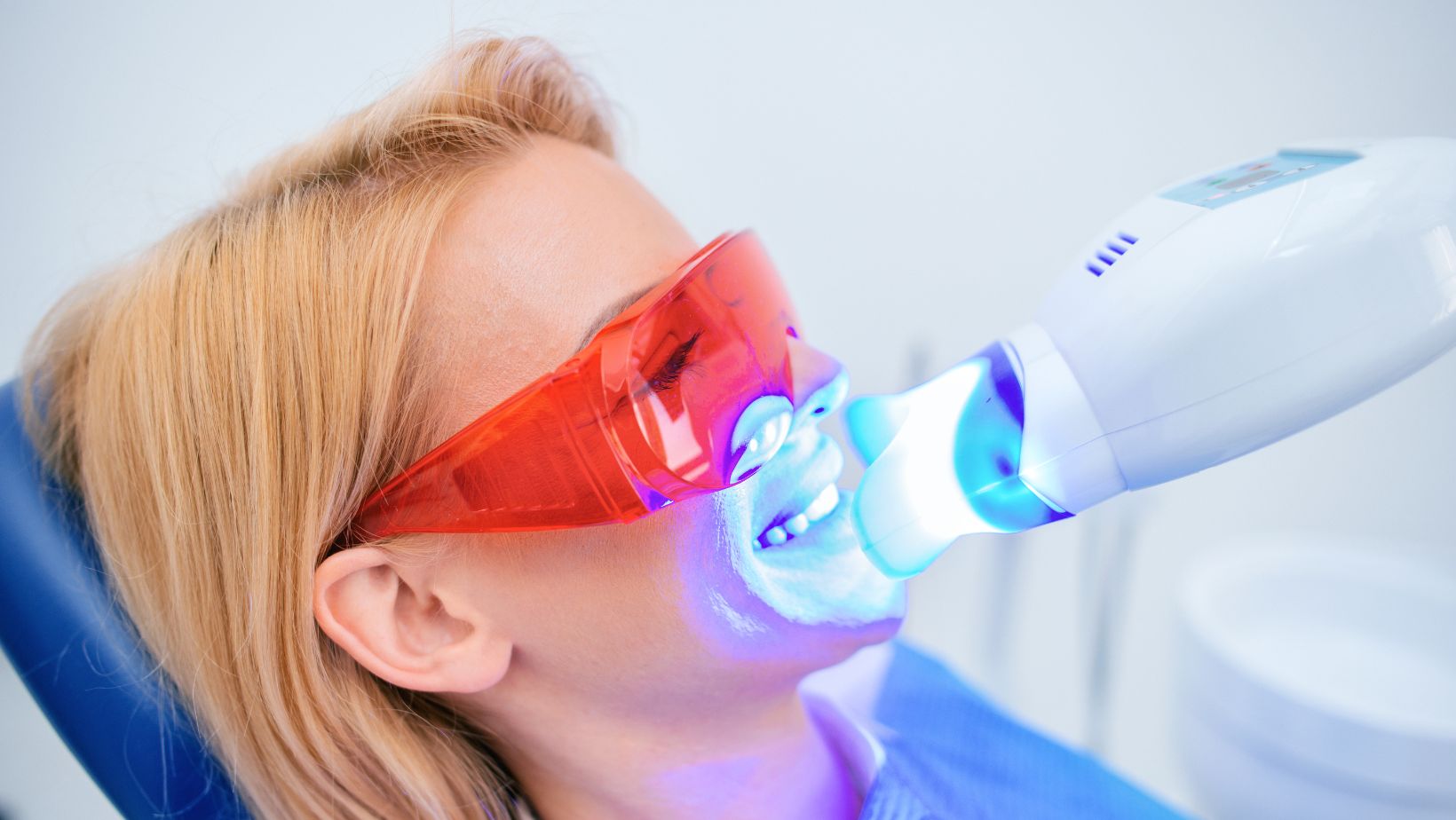 What Custom Teeth Whitening Products Do Onuge Offer?